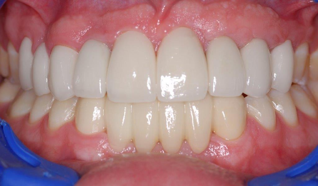 Case 10: after dental treatment