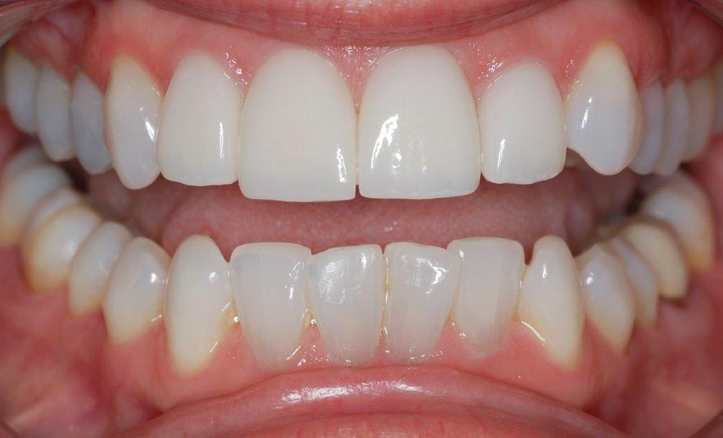 Case 11: after dental treatment