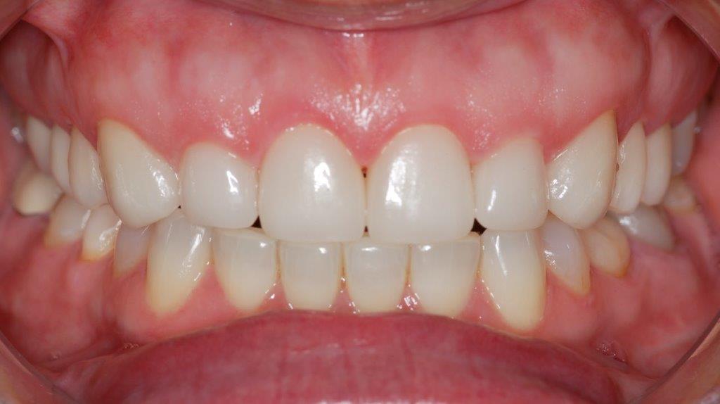 Case 12: after dental treatment