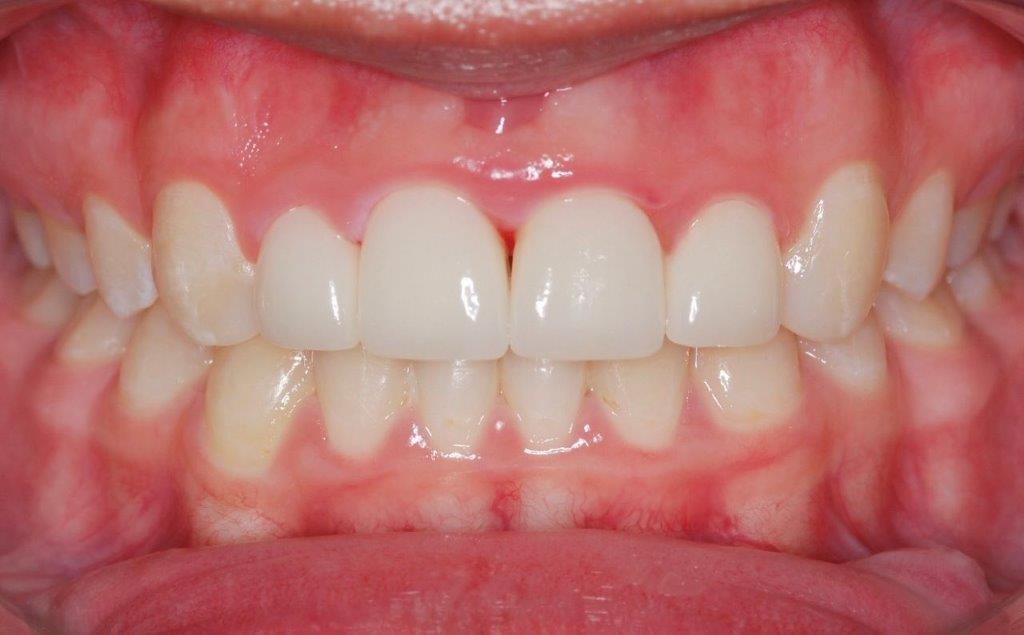 Case 14: after dental treatment