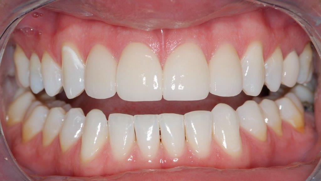 Case 15: after dental treatment
