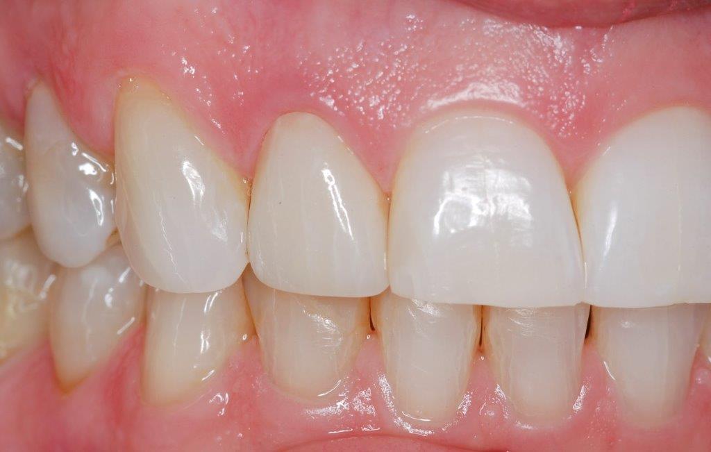 Case 16: after dental treatment