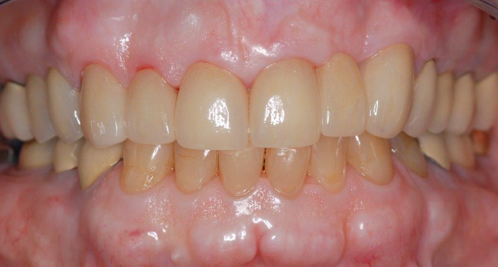 Case 17: after dental treatment
