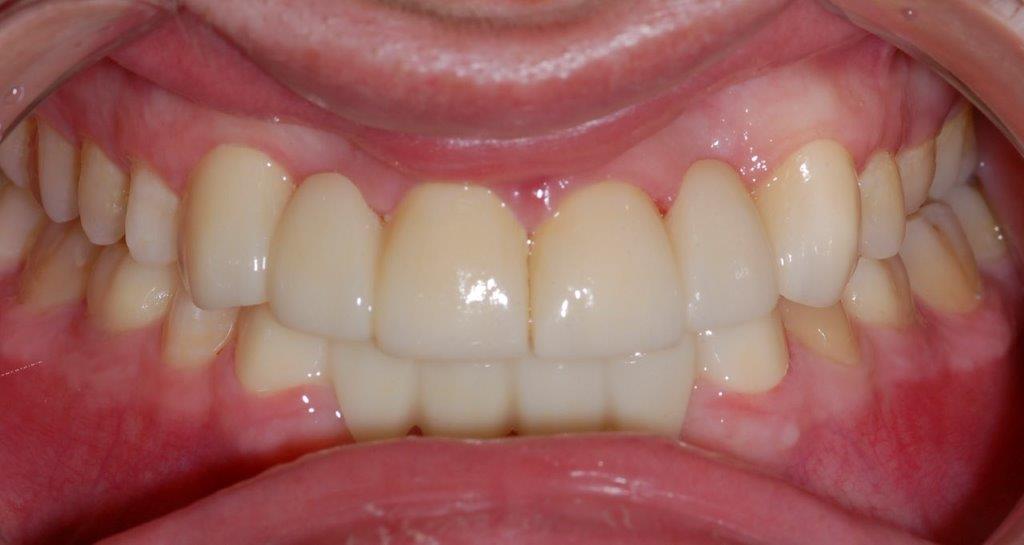 Case 18: after dental treatment