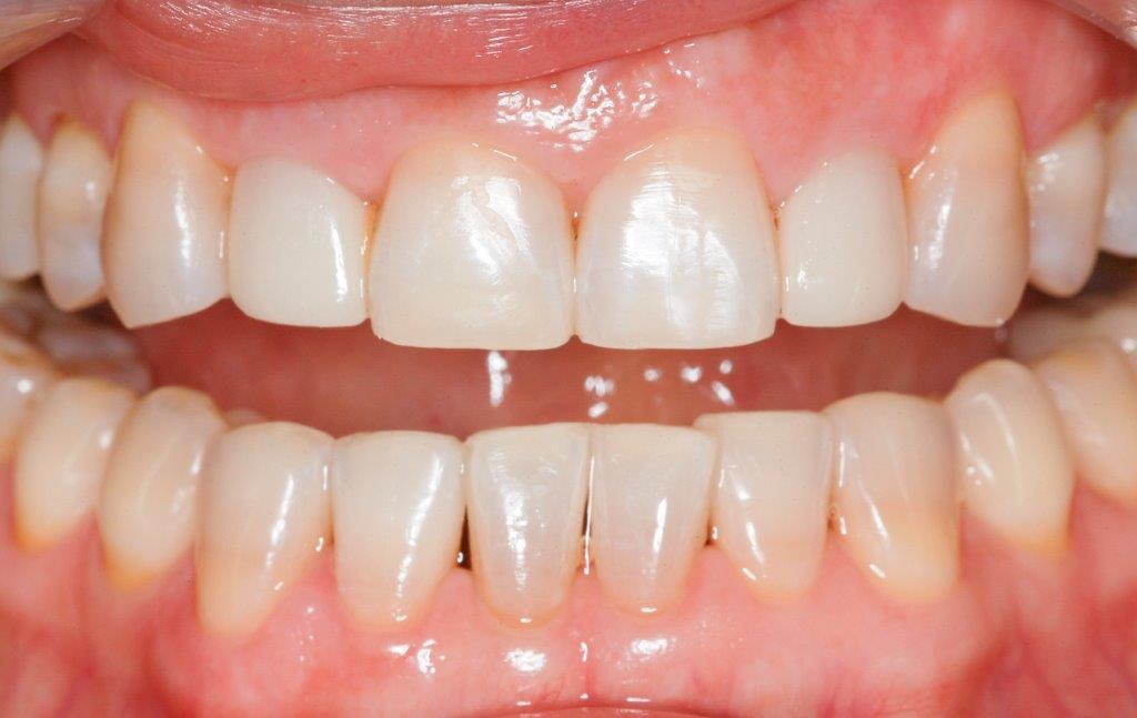 Case 21: after dental treatment