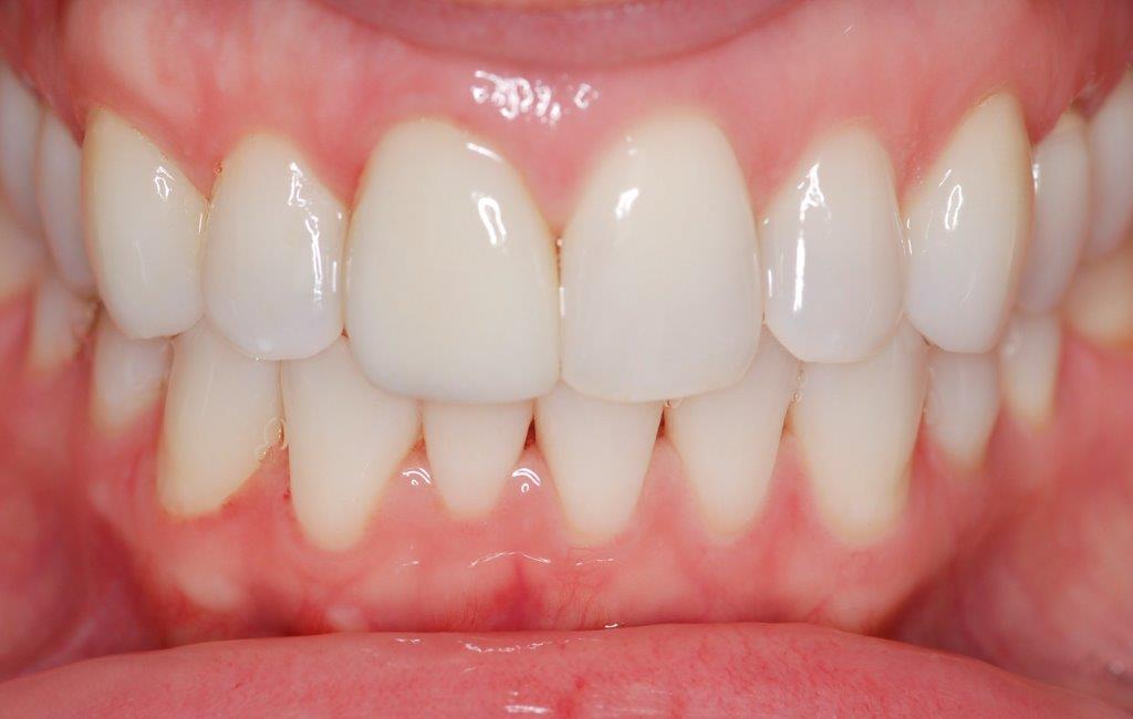 Case 22: after dental treatment
