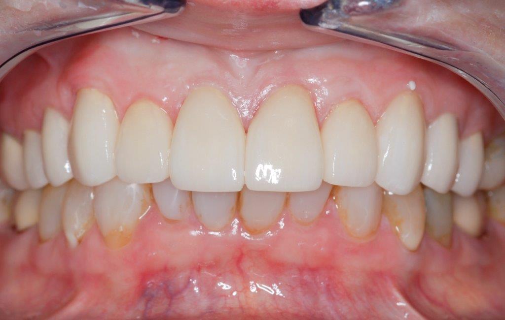Case 24: after dental treatment