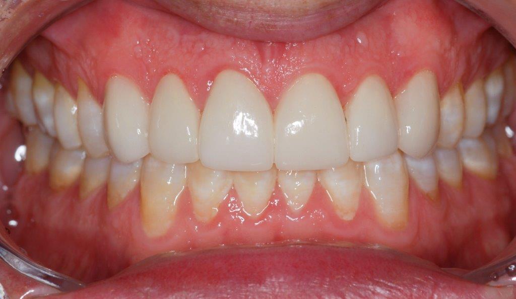 Case 3: after dental treatment