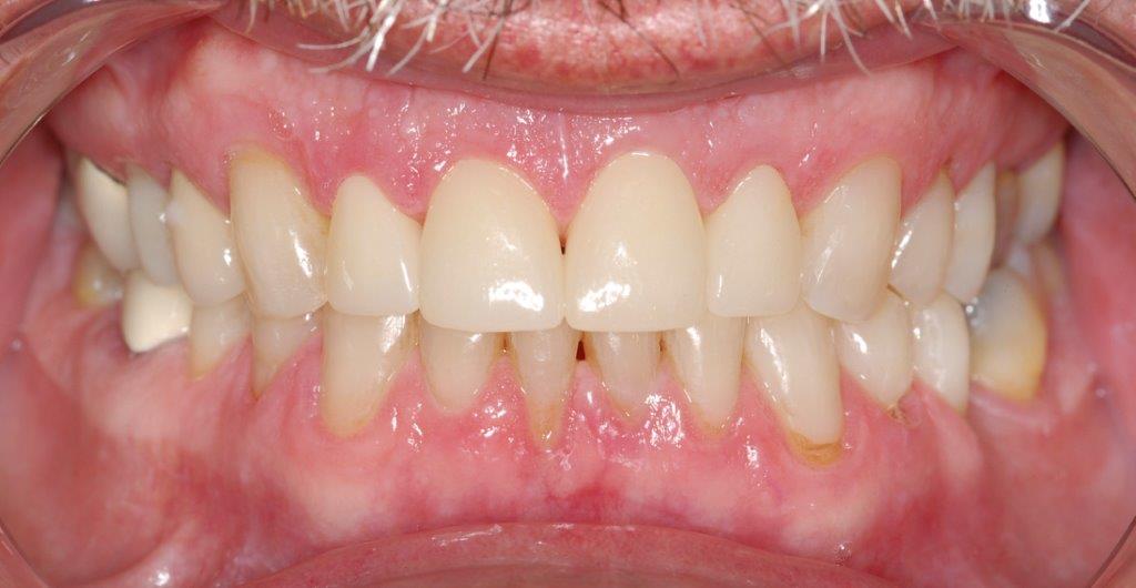 Case 8: after dental treatment