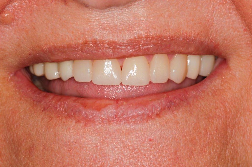 Case 9: after dental treatment