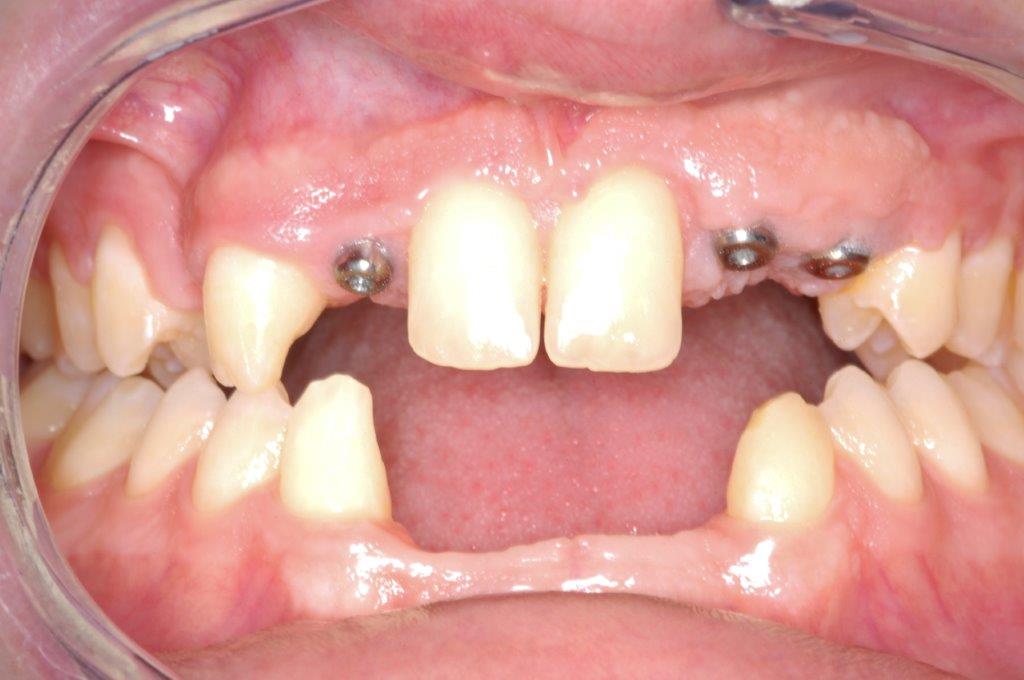 Case 10: before dental treatment