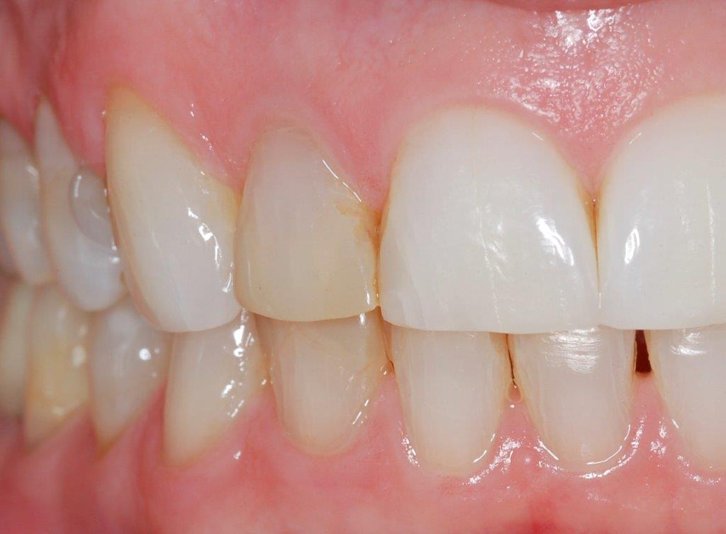 Case 16: before dental treatment