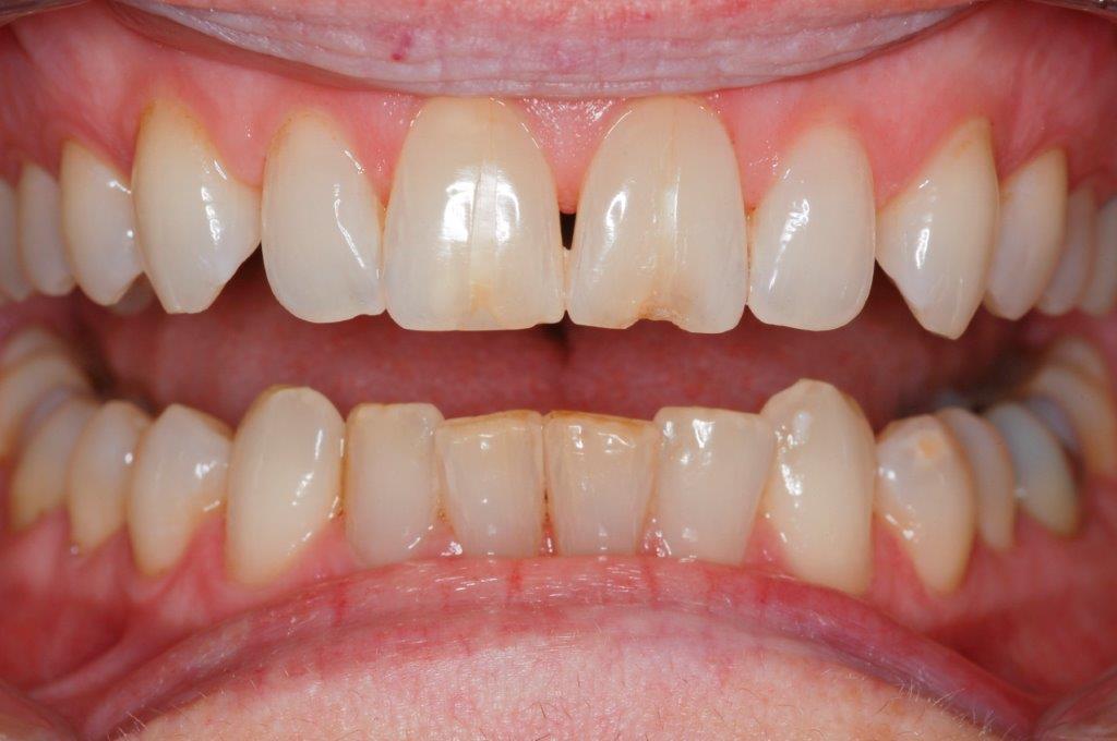 Case 2: before dental treatment