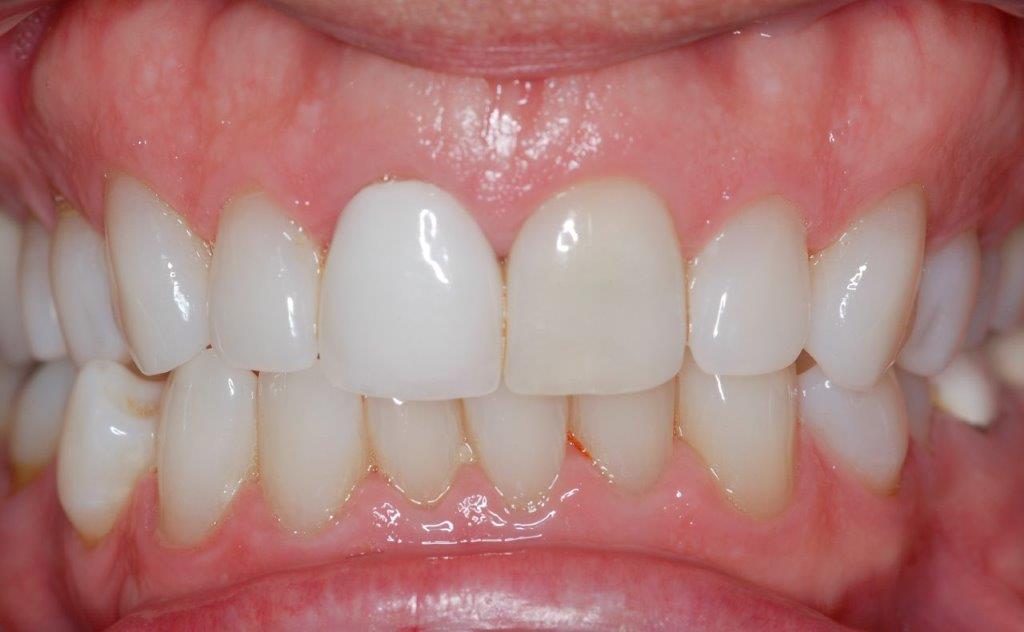 Case 20: before dental treatment