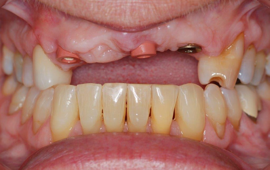 Case 23: before dental treatment