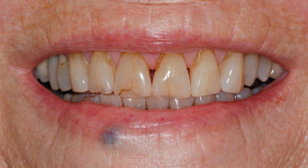 Case 7: before dental treatment