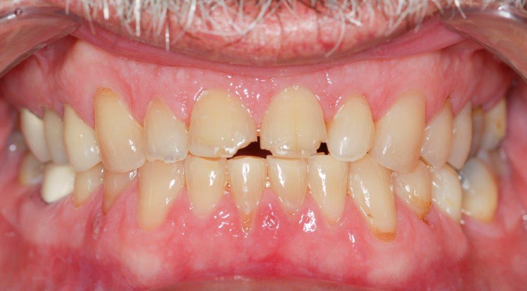 Case 8: before dental treatment