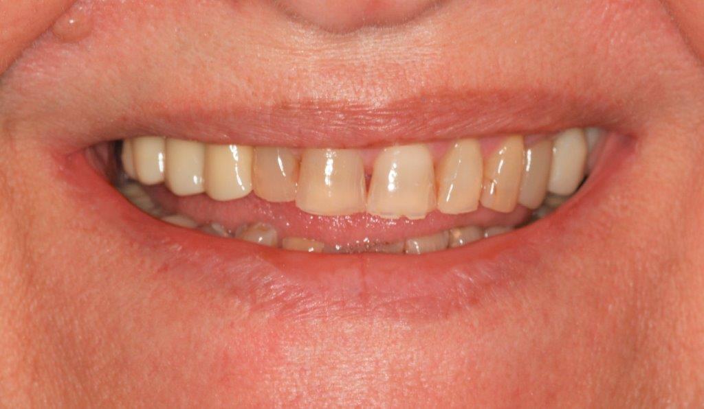 Case 9: before dental treatment